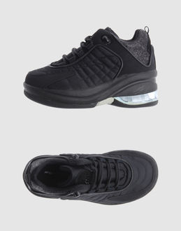 Fornarina chaussures sneakers