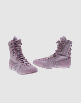 Fornarina chaussures sneakers